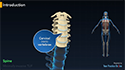 Minimally Invasive TLIF